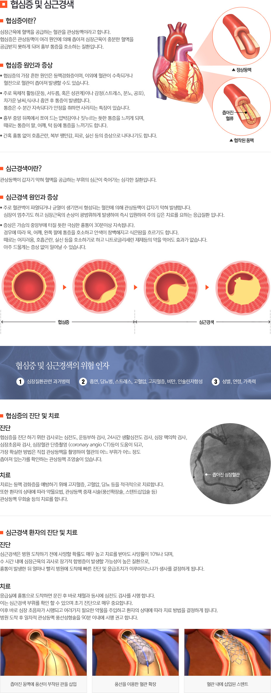 협심증 및 심근경색